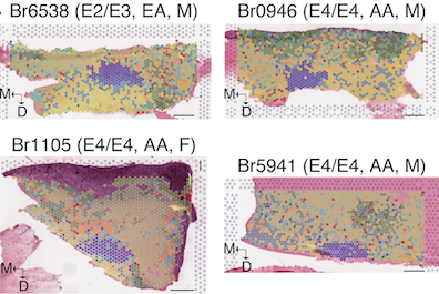 The LC and surrounding spatial domains